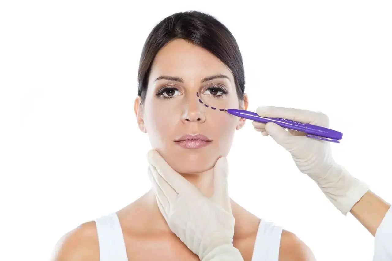 Blépharoplastie sans chirurgie : Rajeunir le regard avec la technique du resurfacing